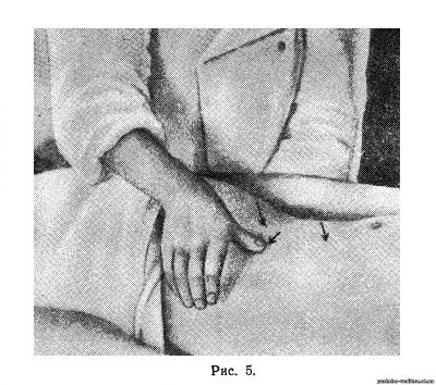 Техника массажа посредством повторных нажиманий пальцем